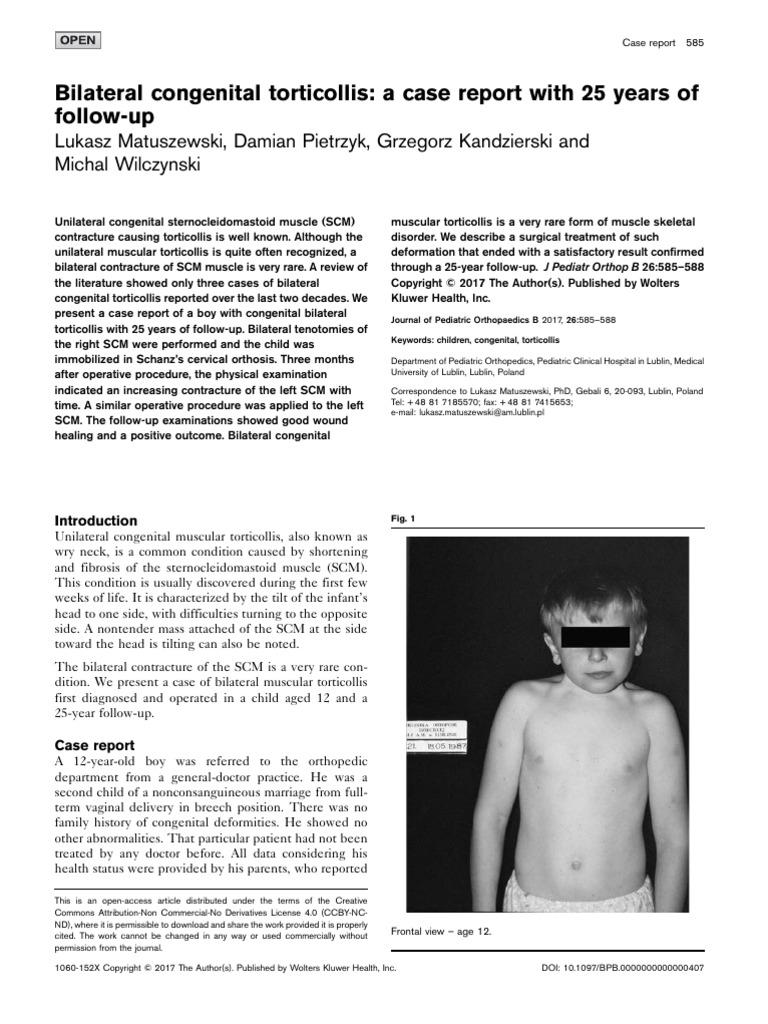 Bilateral Congenital Torticollis A Case Report Wit | PDF ...