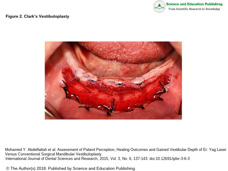10 12691 Ijdsr-3-6-3 Fig - 2 | PDF