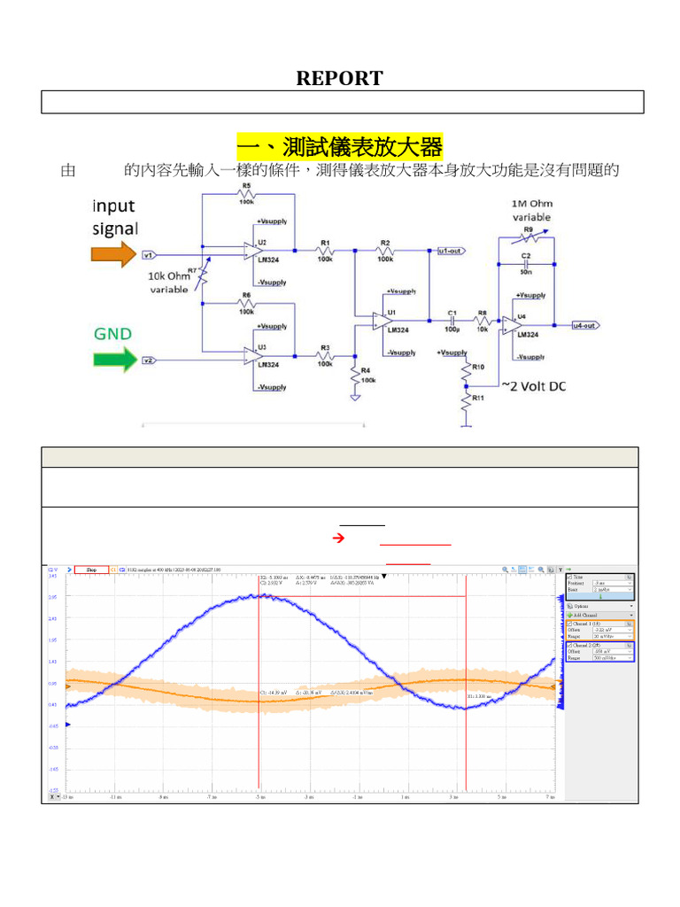 FINAL RE Electrocardiography (ECG) | PDF | Electrocardiography ...