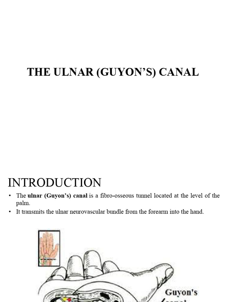 Guyon's Canal: Anatomy and Syndrome | PDF