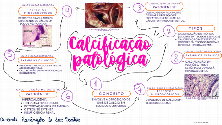 Mapa Mental de Calcificação Patológica | PDF