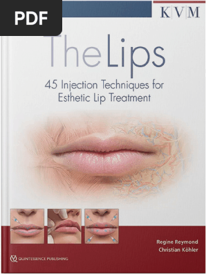The Lips-45 Injection Techniques For Esthetic Lip Treatment