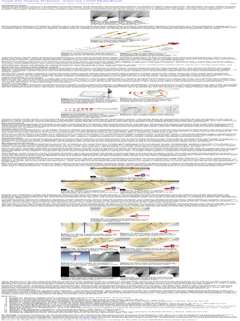 Single-File Shaping in Endodontics | PDF