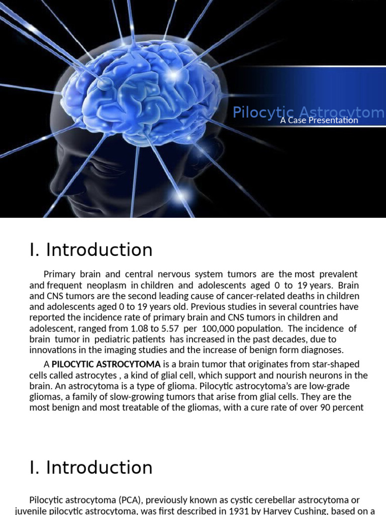 Pilocytic Astrocytoma 2 | PDF | Brain Tumor | Memory