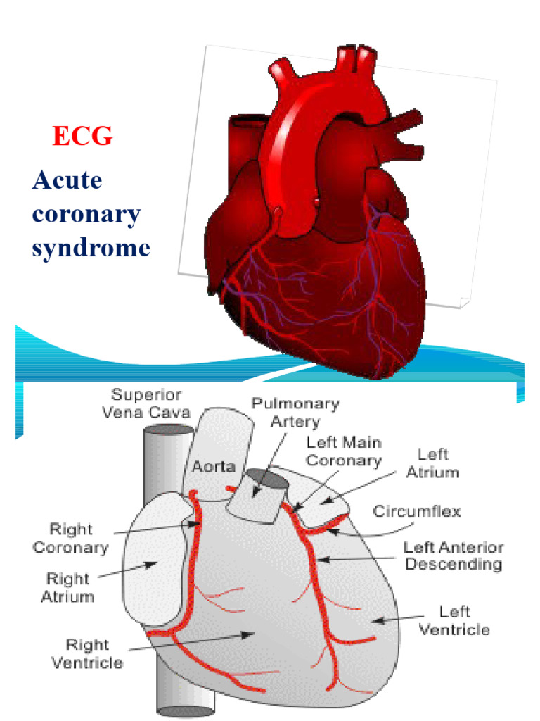 Acute Coronary Syndrome ECG Guide | PDF | Electrocardiography ...