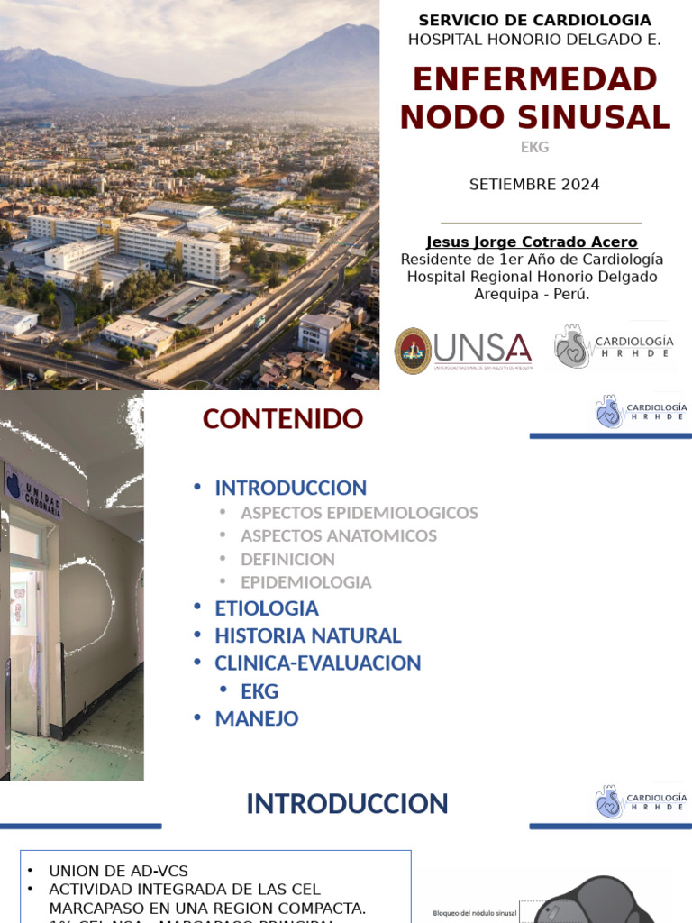 Disfuncion Nodo Sinusal 2024 | PDF | Electrocardiografia | Causas de la ...