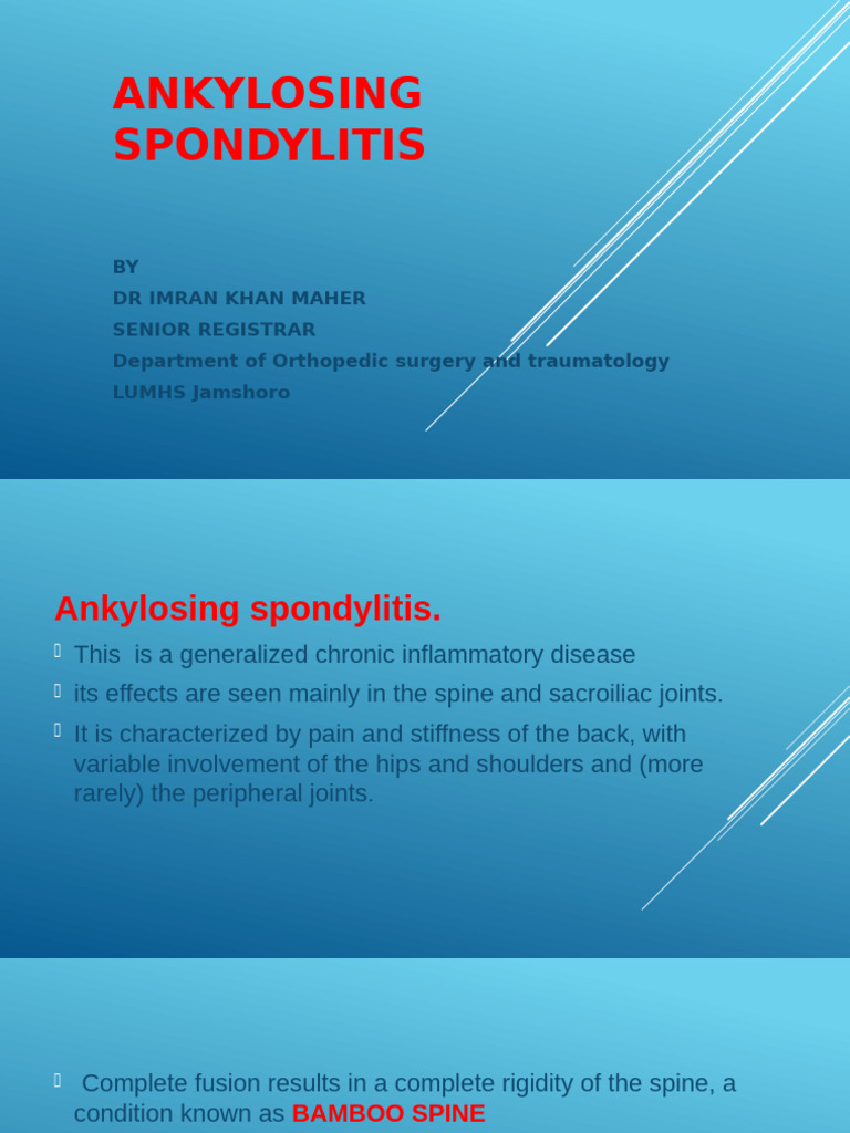 Understanding Ankylosing Spondylitis | PDF | Vertebral Column ...