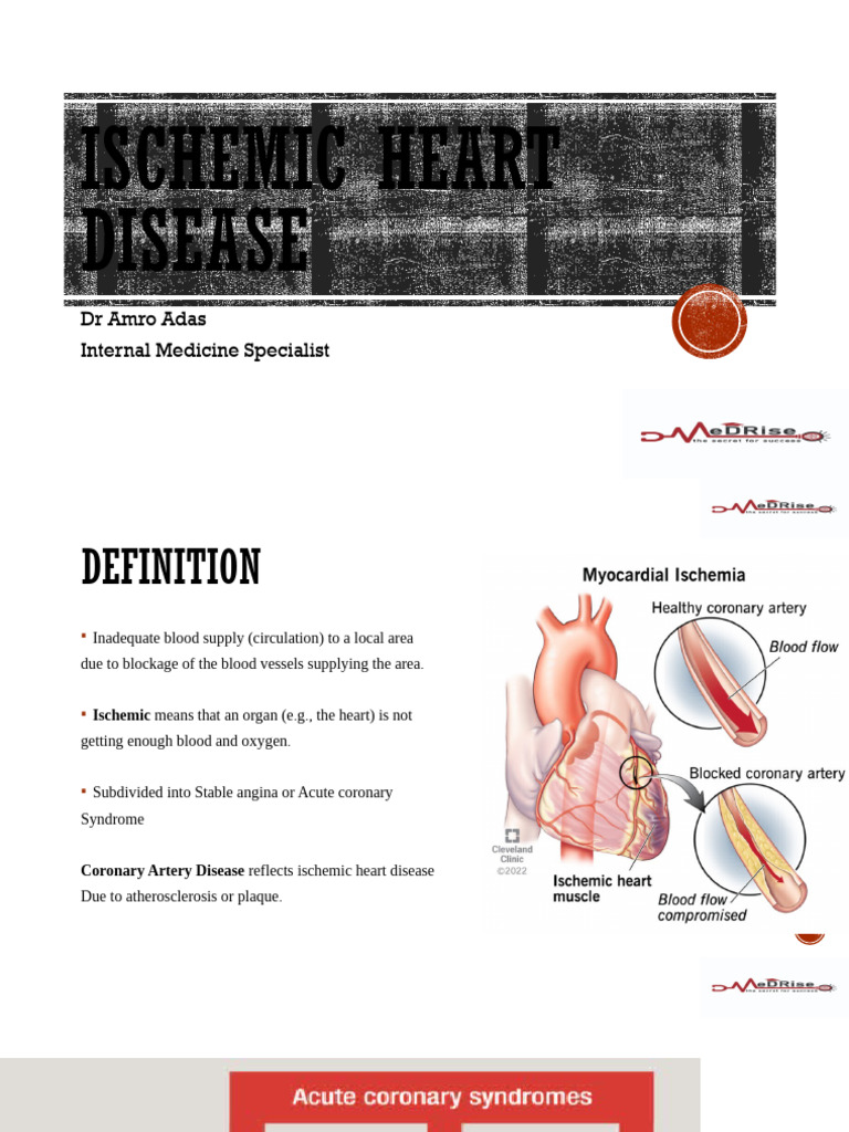 Ischemic Heart Disease Overview | PDF | Coronary Artery Disease ...