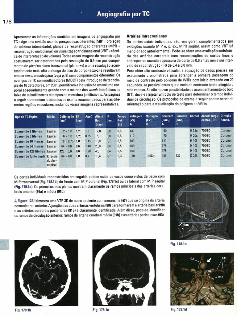 15 - Angiografia Por TC - Teste Seus Conhecimentos | PDF