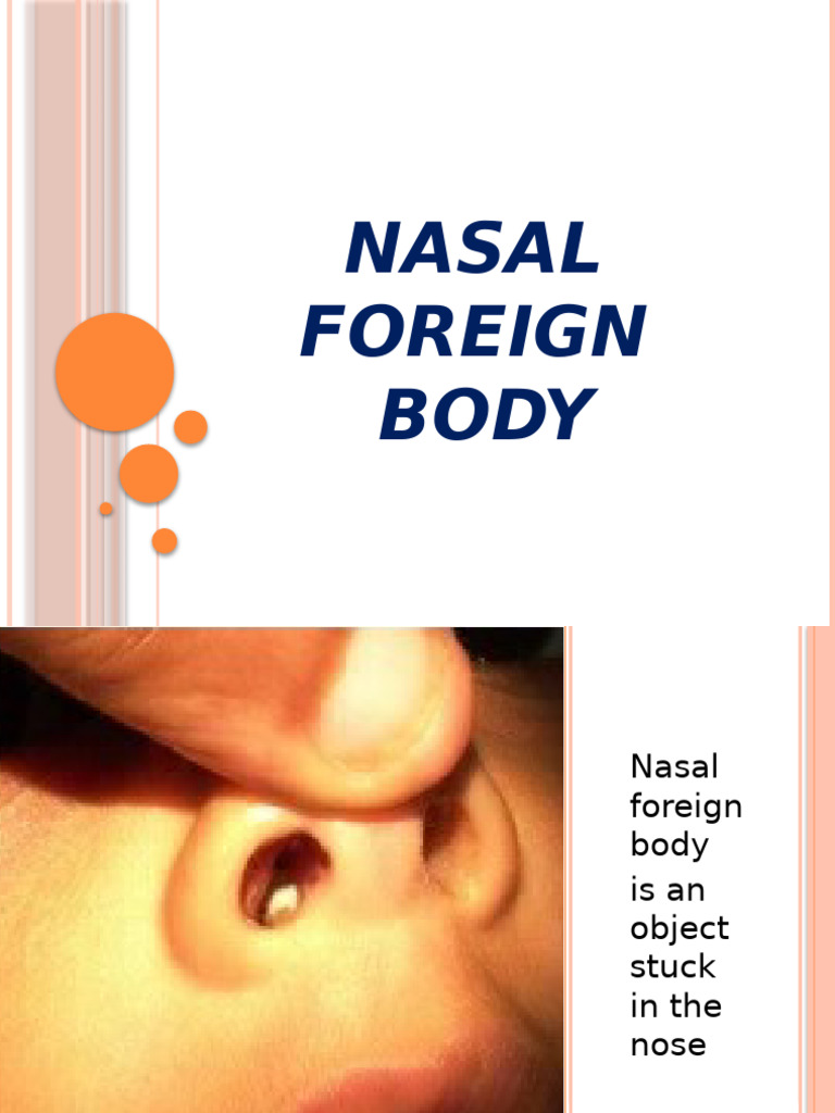 Nasal Foreign Body | PDF