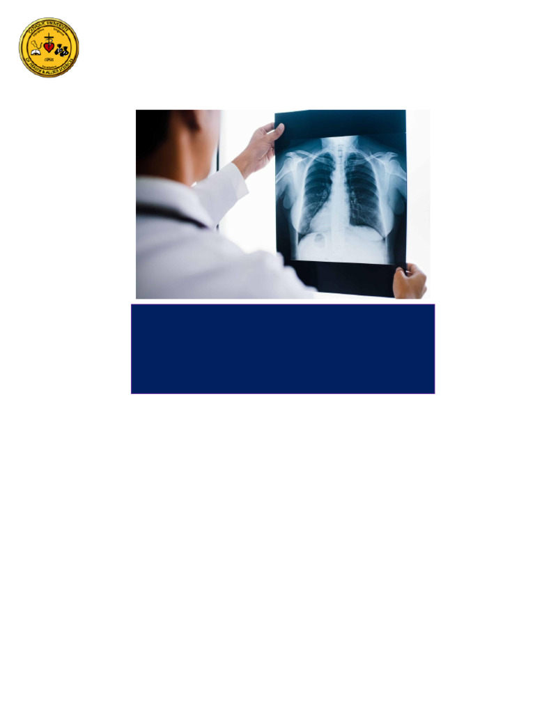 Pulmonary Infection TB Hiv &aids | PDF | Pneumonia | Tuberculosis