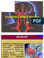 Accidente Cerebro Vascular