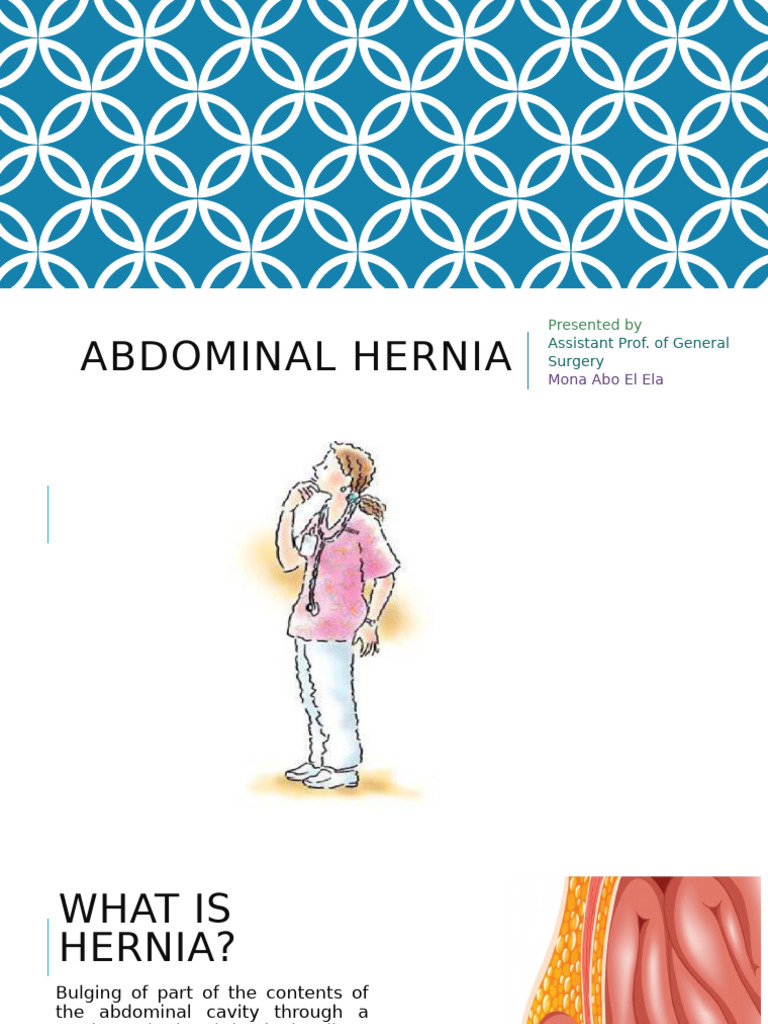Understanding Abdominal Hernias: Types & Management | PDF | Abdomen
