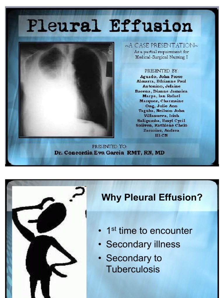 pleural effusion case study pdf