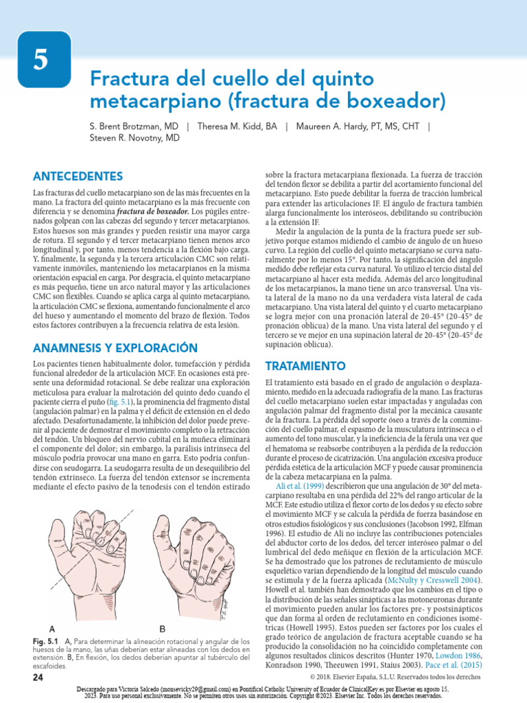 Fractura Del Cuello Del Quinto Metacarpiano (Fractura de Boxeador ...