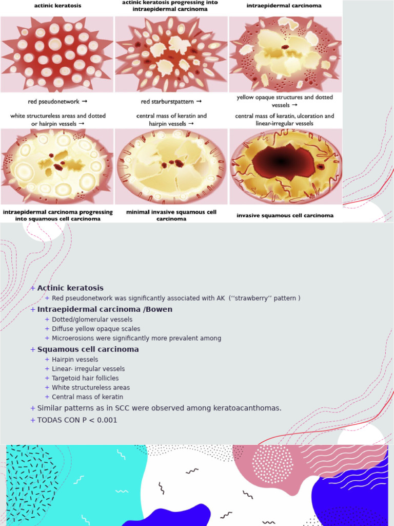 Dermoscopic Patterns in Skin Lesions | PDF | Skin | Anatomy