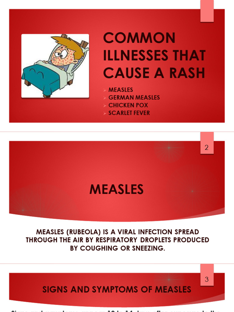 Common Rash-Causing Illnesses | PDF | Measles | Immunology