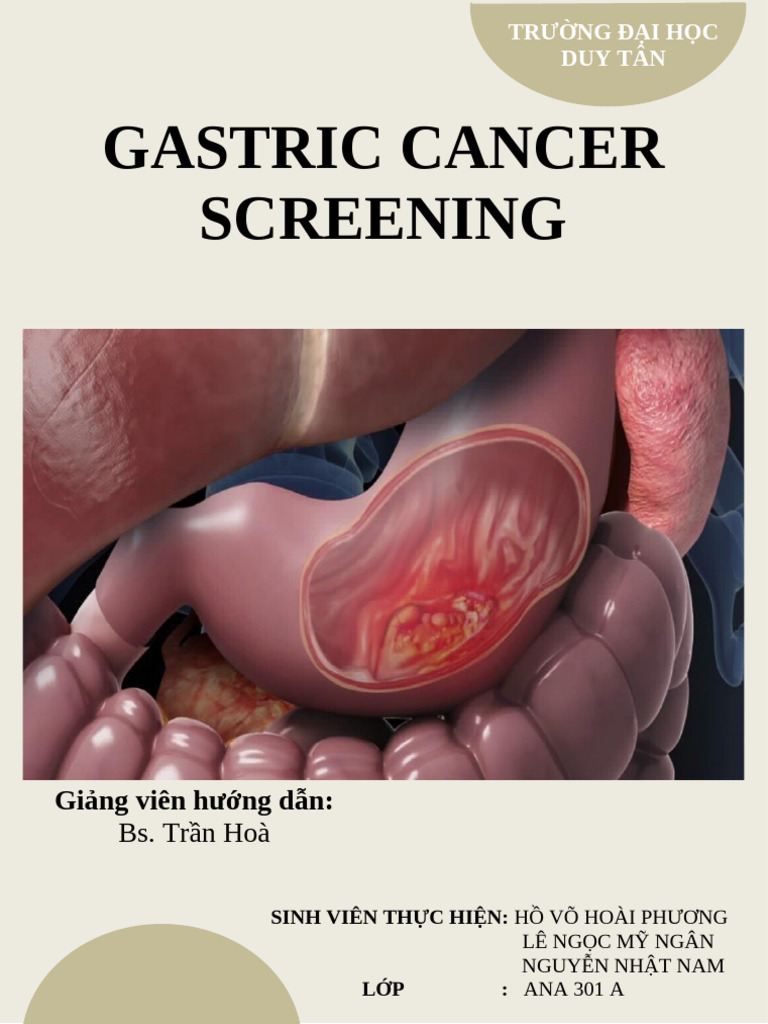 Gastric Cancer Screnning | PDF