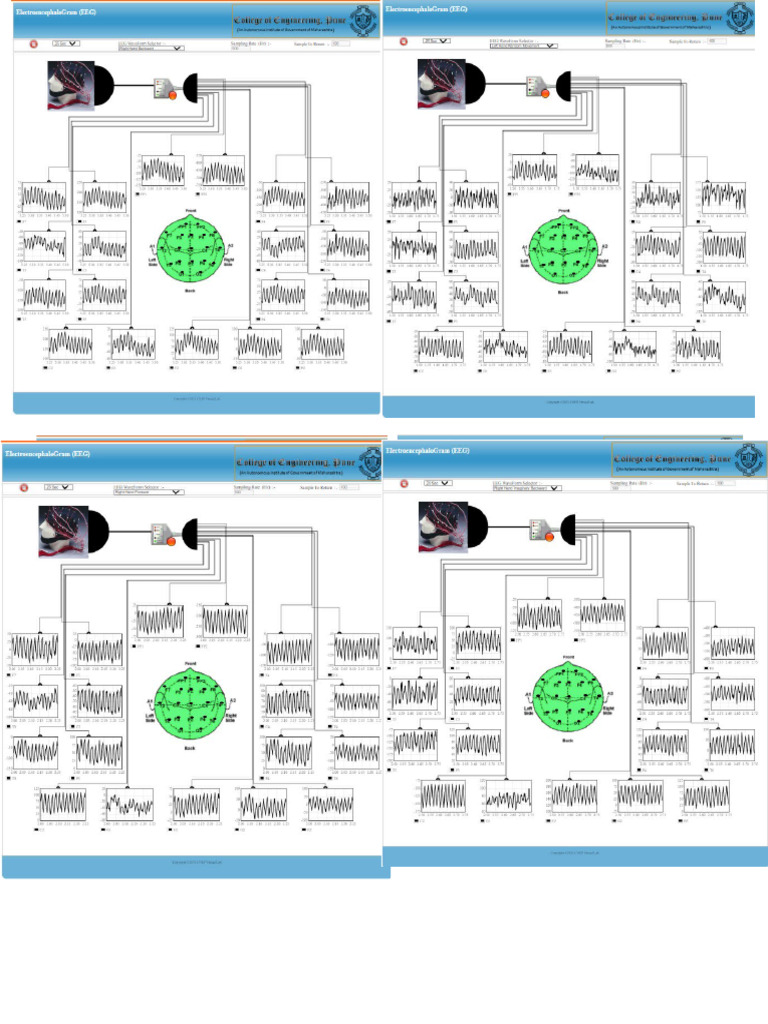 Virtual Lab Eeg Analysis | PDF
