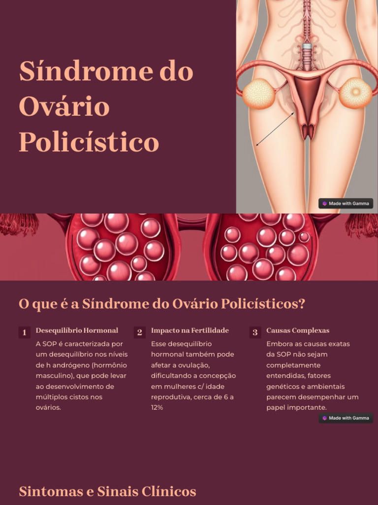 sindrome-do-ovario-policistico-pdf-s-ndrome-dos-ov-rios