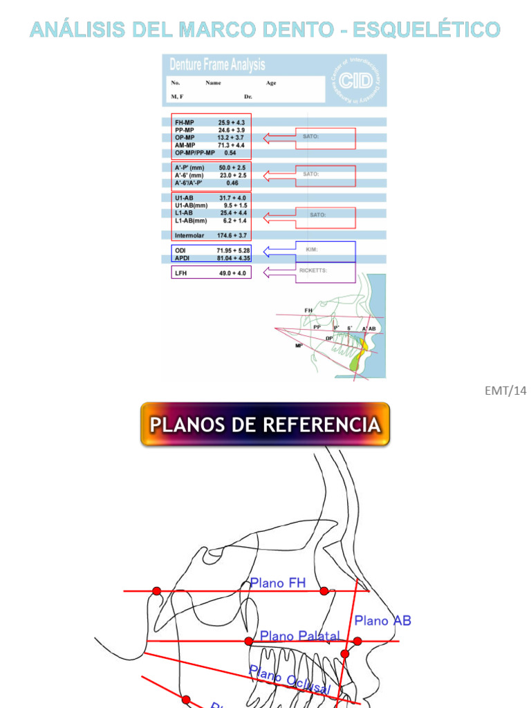 Denture Frame Analysis (Resumen) | PDF
