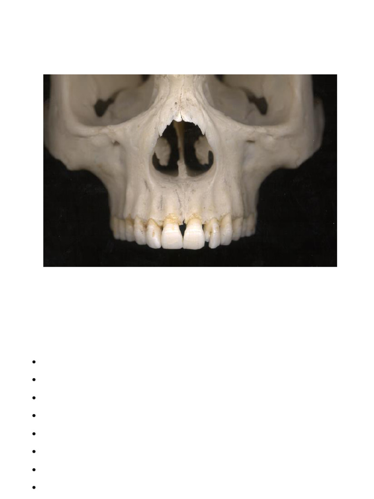Maxilla Radiographic Anatomy Overview | PDF | Human Nose ...