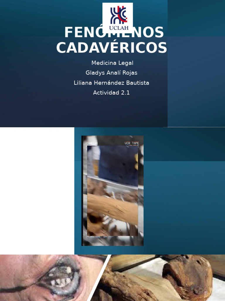 Fenómenos Cadavéricos en Medicina Legal | PDF | Cadáver