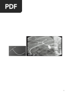 Laparoscopic Cholecystectomy Guide | PDF | Gallbladder | Liver