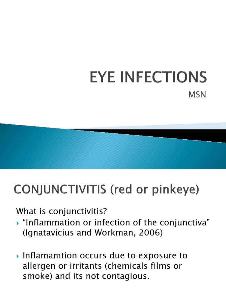 Eye Infections | PDF | Immunology | Health Sciences