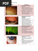 RGP Contact Lens Complications Guide | PDF | Contact Lens | Cornea