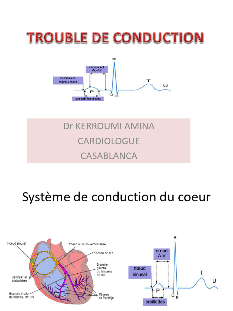 Troubles du rythme cardiaque et HTA | PDF | Hypertension artérielle ...