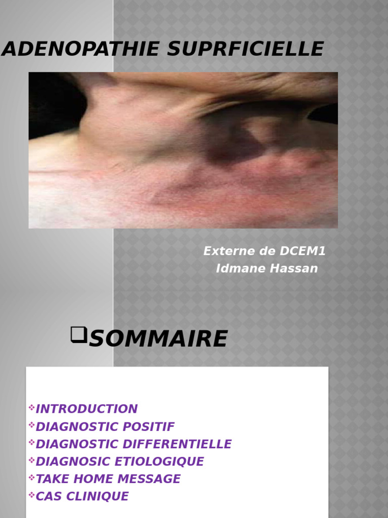 Adénopathie superficielle diagnostic et étiologie PDF Infection — free download