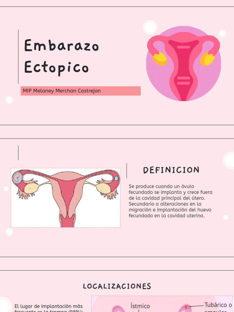Embarazo Ectópico: Diagnóstico y Tratamiento | PDF | El embarazo ...