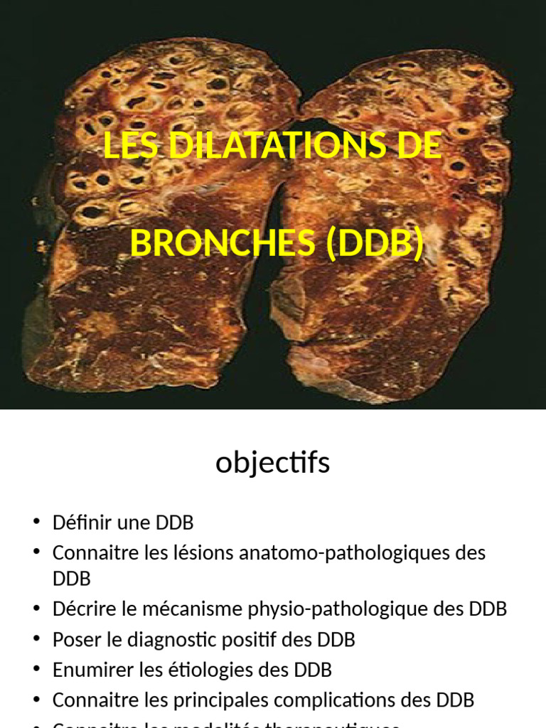 Dilatation des bronches : Définitions et traitements | PDF ...