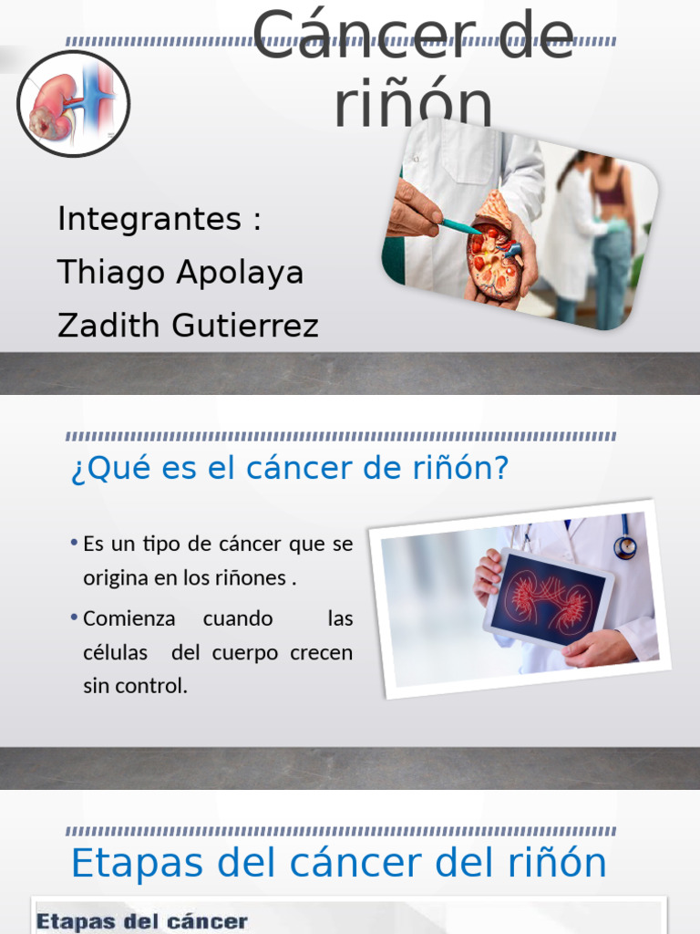 Expo Cancer Riñon | PDF