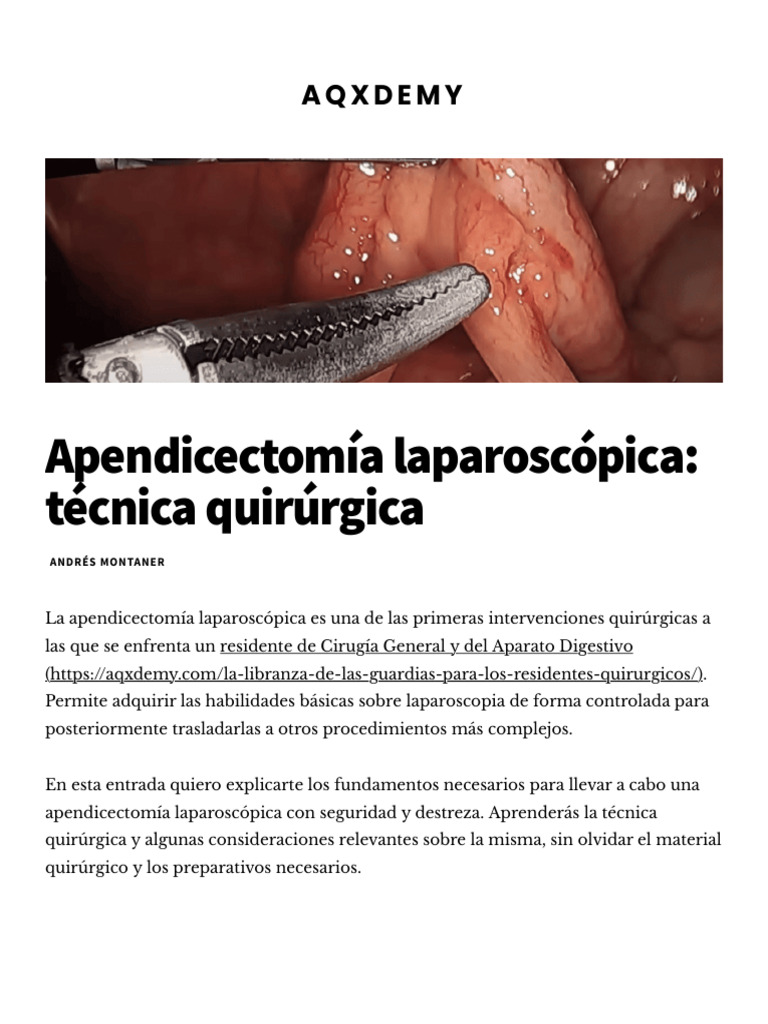 Apendicectomía Laparoscópica Teecnica | PDF | Cirugía | Medicina CLINICA