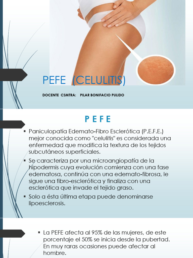 Pefe (Celulitis) JH PBP | PDF | Causas de la muerte | Especialidades ...