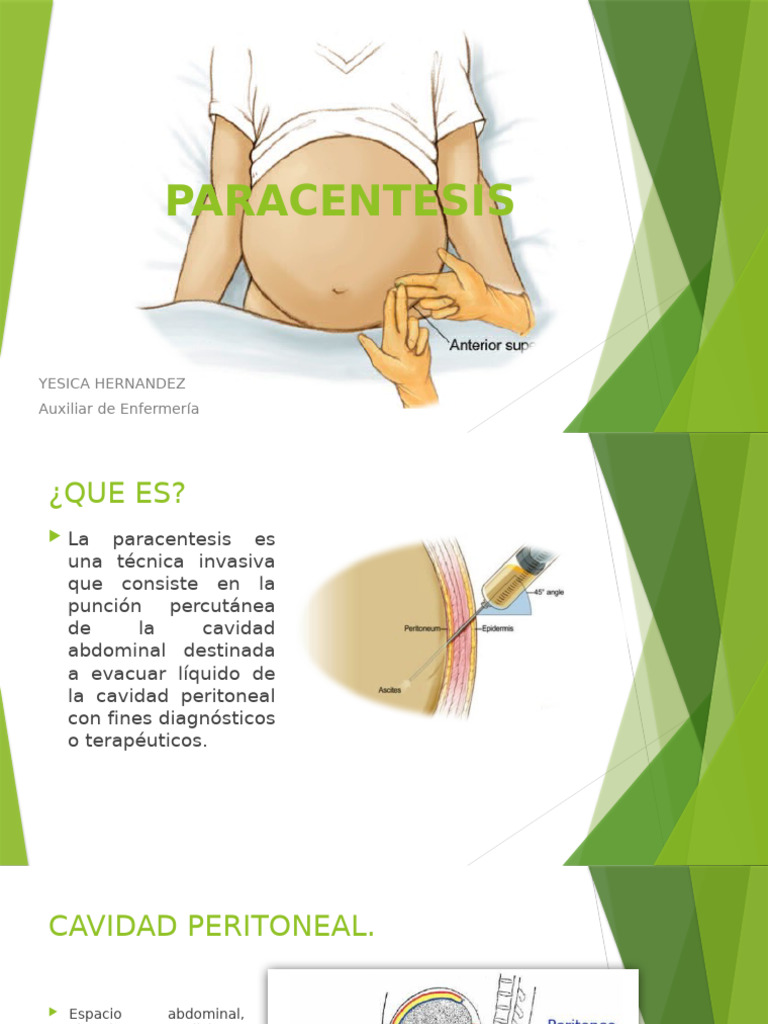 Paracentesis Evacuatoria | PDF | Abdomen | Peritoneo