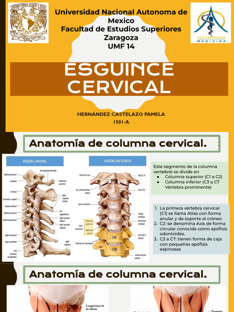 Clasificación y Tratamiento del Esguince Cervical | PDF | La columna ...