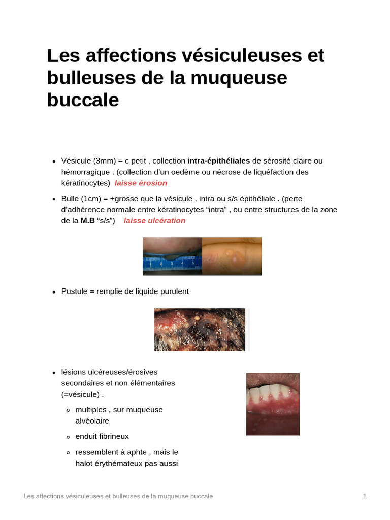 Affections vésiculeuses buccales | PDF | Dermatologie | Dermatose