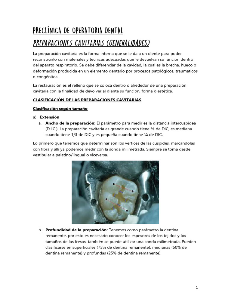 preparaci-n-cavitaria-en-premolares-pdf-esmalte-de-dientes