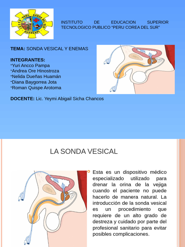 Sonda Vesical y Edemas | PDF | Estreñimiento | Especialidades Medicas