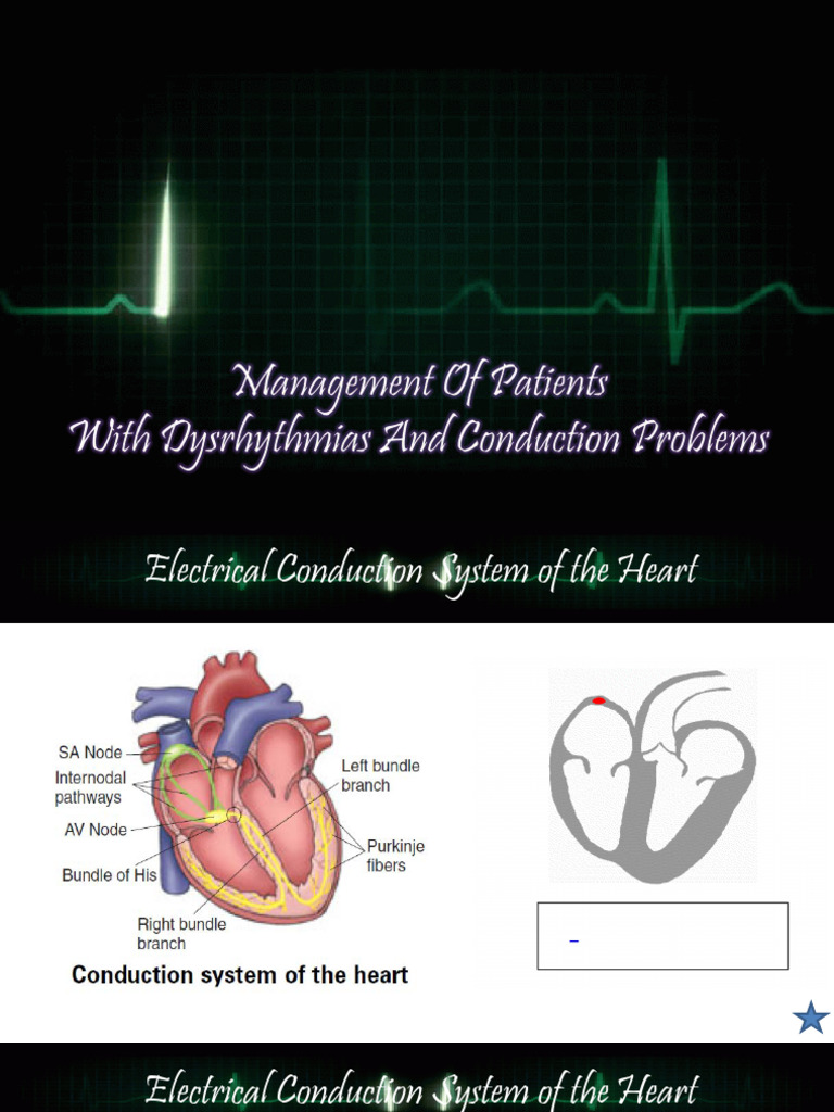 Heart's Electrical Conduction System Explained | PDF ...