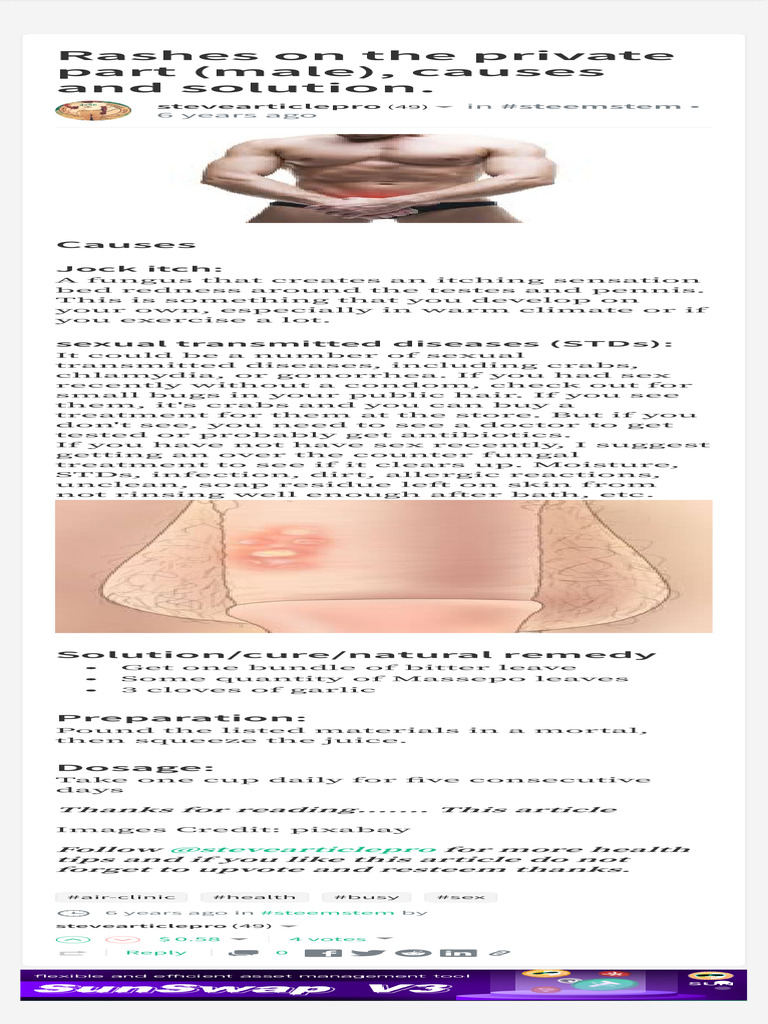 Rashes On The Private Part (Male), Causes and Sol | PDF