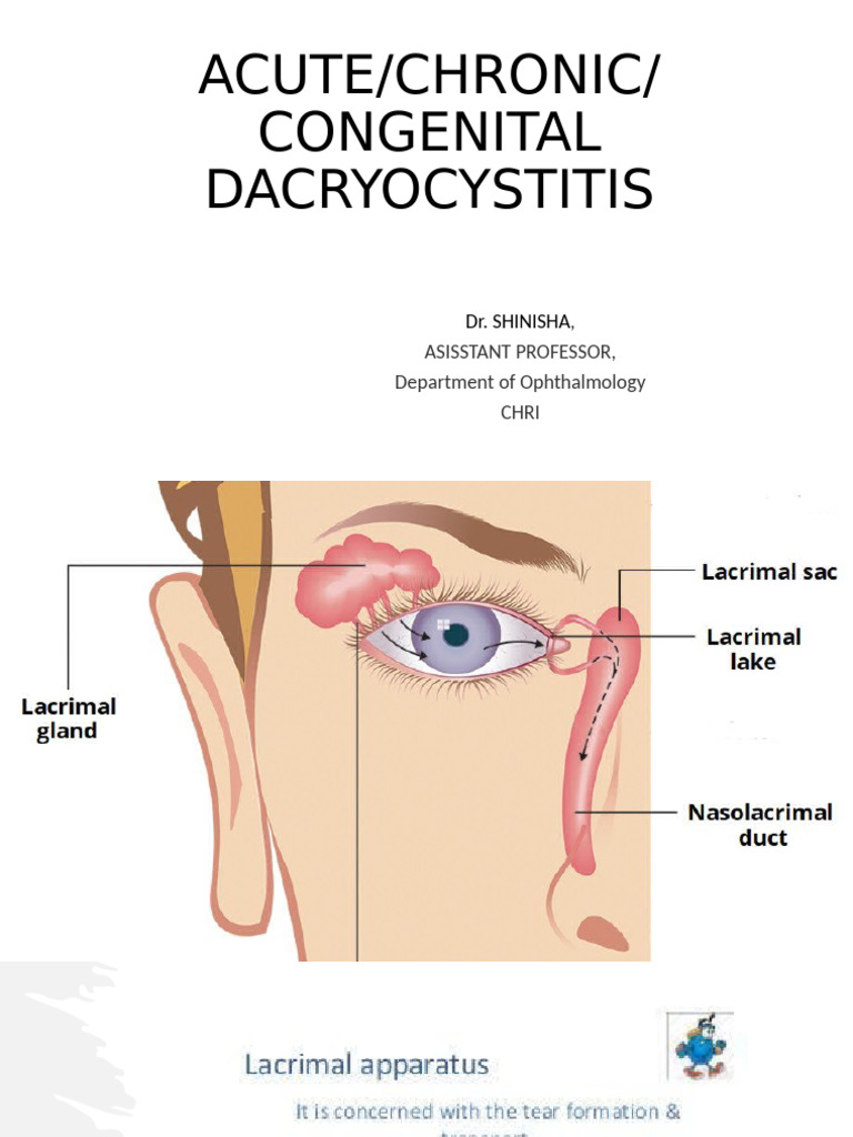 Types and Treatment of Dacryocystitis | PDF | Diseases And Disorders ...