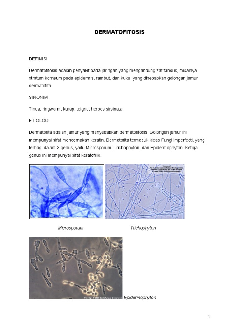Diabetes Tipe 2 Adalah Pdf