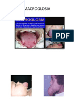 Macroglosia Presentacion 2