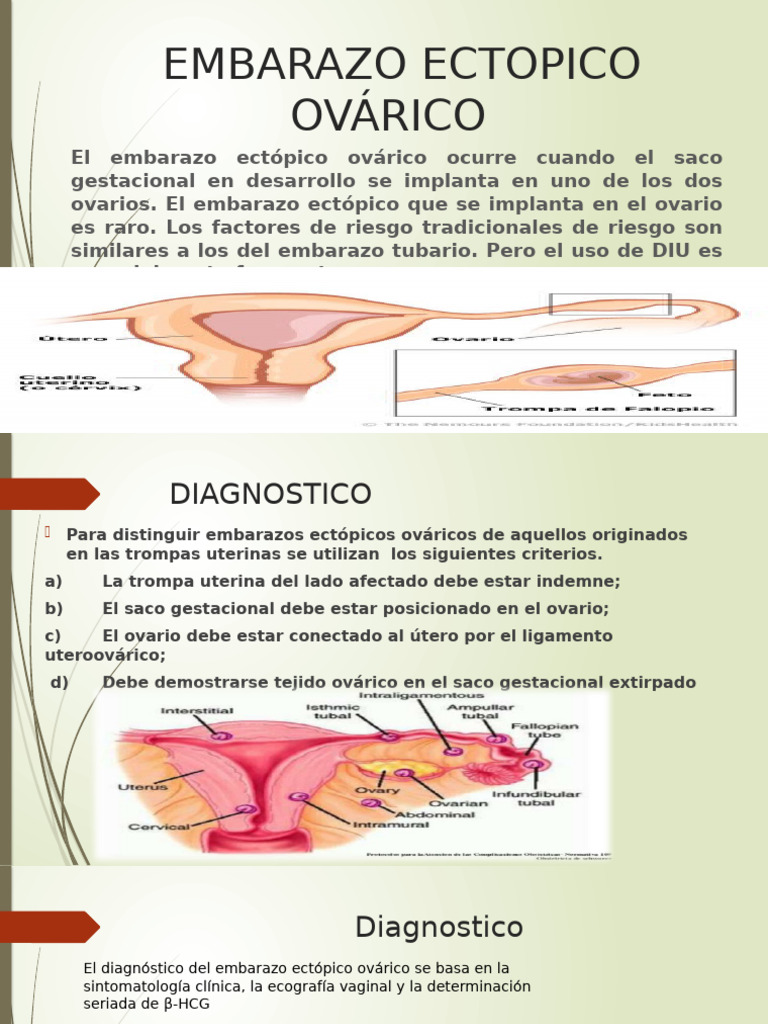 EMBARAZO ECTOPICO Vondr | PDF | El embarazo | Embarazo humano