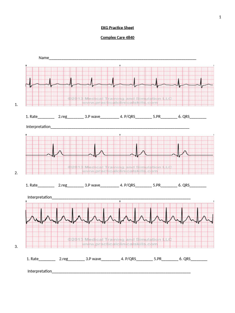 EKG Interpretation Practice Sheet | PDF | Cardiac Arrhythmia ...