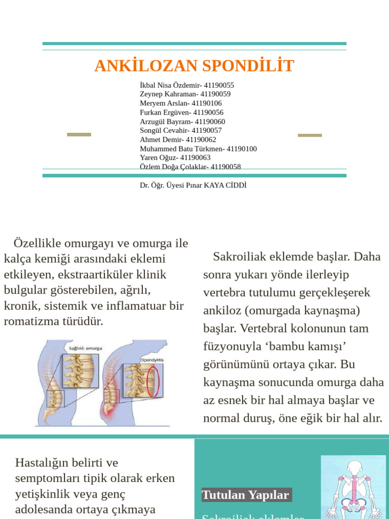 Ankilozan Spondilit | PDF